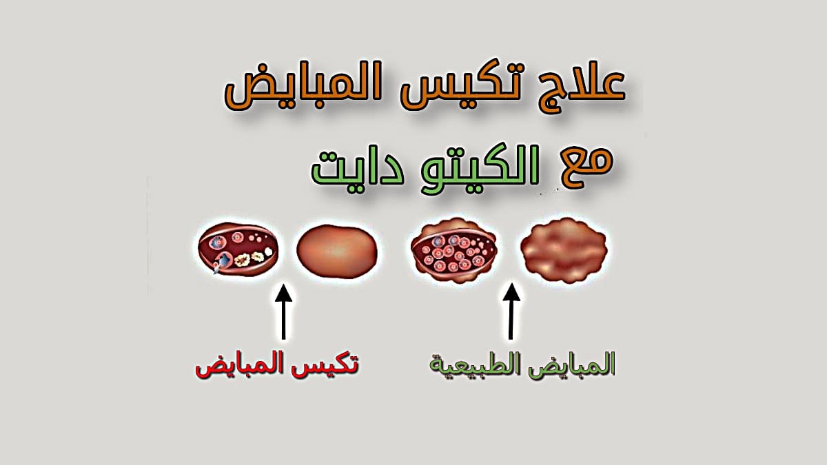 احسن نظام كيتو دايت - بيحافظ على الصحة جدا